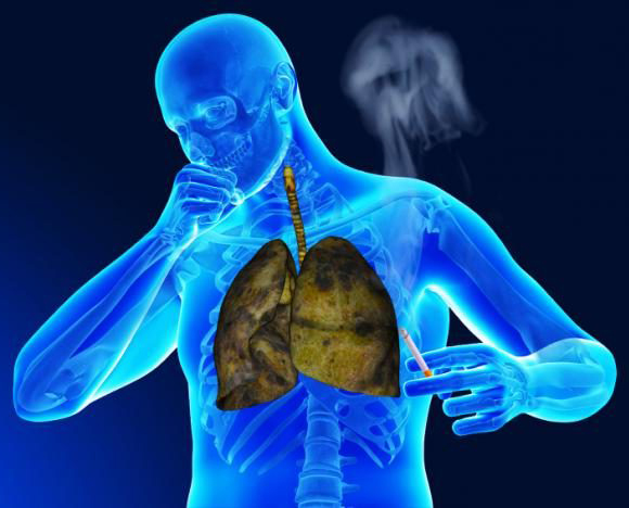 Respiratory medicine specialist in Delhi